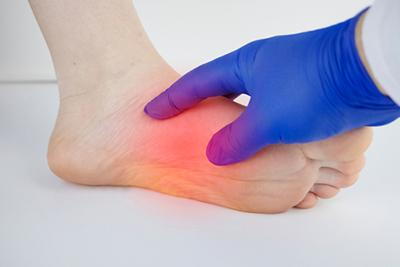 Person-holding-its-foot-in-arch-pain-color-red-with-doctor-in-glove.