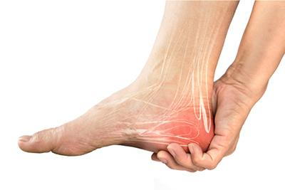 Illustration of heel pain in a person with redness.