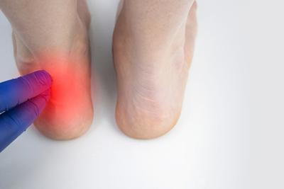 Foot doctor examining a patient’s foot to identify the cause of pain