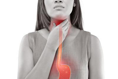 Illustration highlighting acid reflux effects in a woman