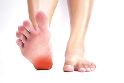 Man-with-Plantar-Fasciitis