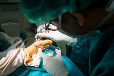 Foot-Doctor-During-Foot-Surgery-for-Bunions