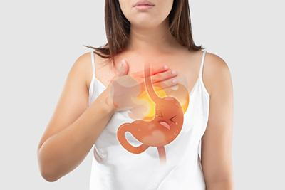 Illustration of acid reflux with 3d graphics