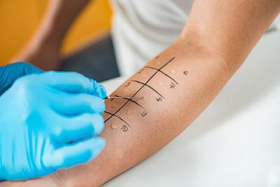 Doctor-Performing-Allergy-Test-on-Male-Patient