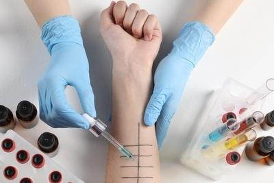 Clinical assistant with gloves using syringe for testing the skin