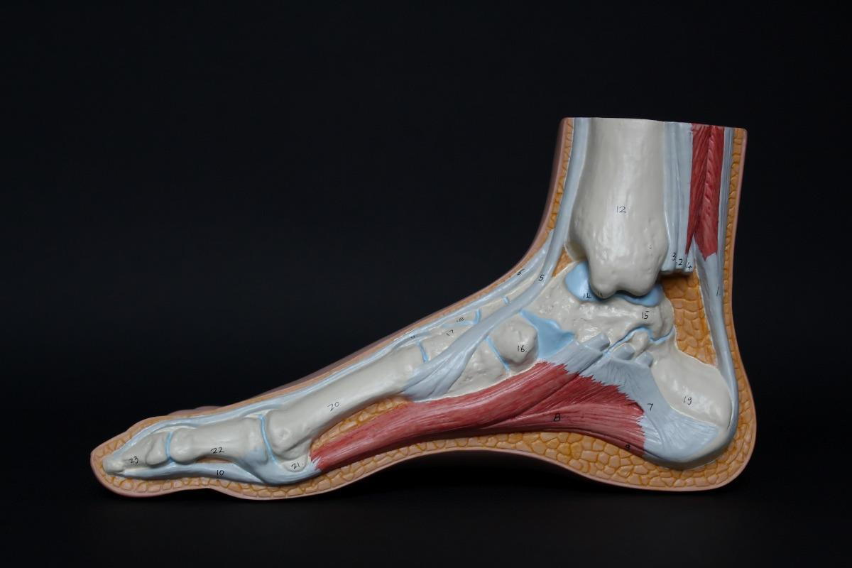 Everything You Need to Know about Achilles Tendonitis