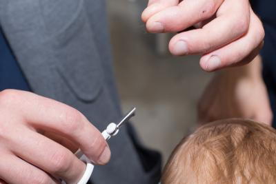 Illustration of Newborn Circumcision