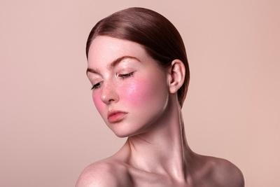 Womans face with rosacea