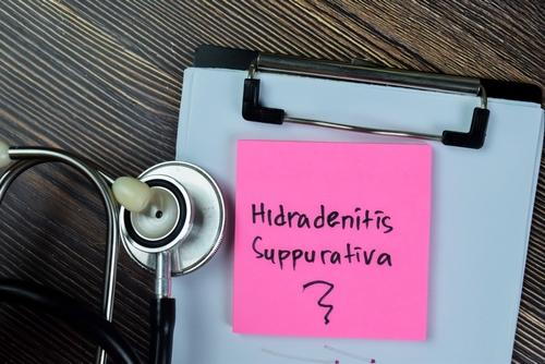 Clipboard with the words "Hidradenitis Suppurativa" written and a stethoscope nearby.