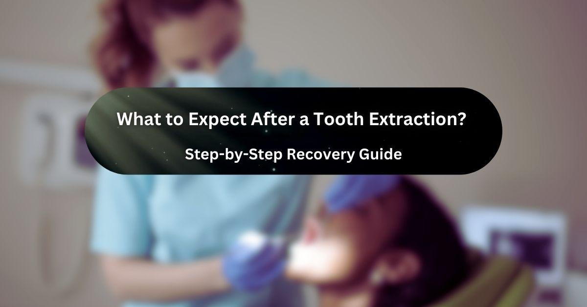 What to Expect After a Tooth Extraction? A Step-by-Step Recovery Guide