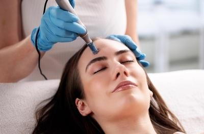 Flawless woman in microneedling with the doctor