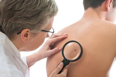 Illustration of Melanoma on skin of patient check by the doctor
