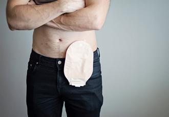 Two Piece Colostomy Bag 1203 Supply
