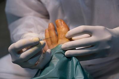 Surgeon performing corrective foot and ankle surgery under sterile conditions.