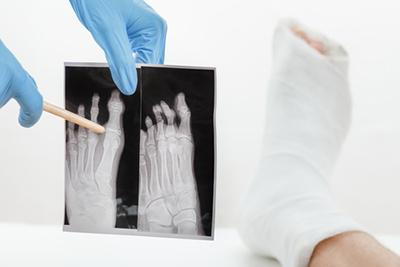 Podiatrist evaluating and explaining foot fracture using X-ray image.