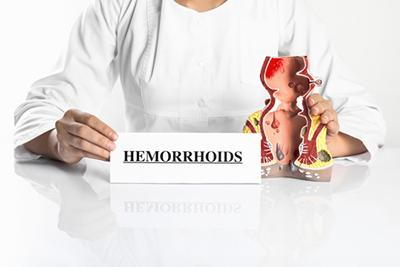 Illustration of Hemorrhoids in model part