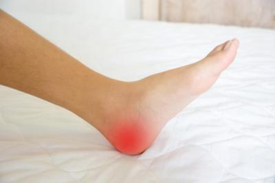 Woman-with-Heel-Pain