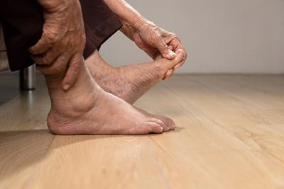 Older woman examines her feet for signs of diabetic complications