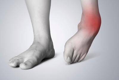 Ankle Sprain in red highlights