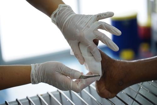 Podiatrist treating diabetic patient’s foot wound