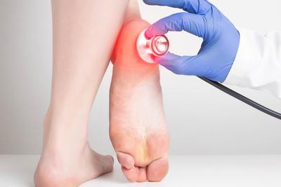 Concept image of treating and checking heel spurs on person