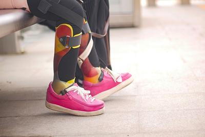 Little girl wearing supportive orthotics