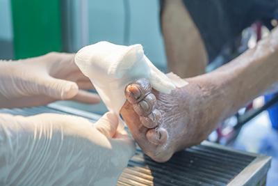 Diabetic Foot Care by doctor on clinic