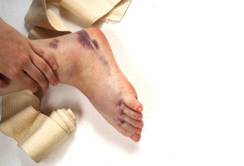 A man holding his ankle, showing signs of a sprain.