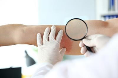 Doctor checking the skin condition of patient