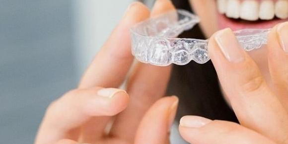 Invisalign Treatment Timeline
