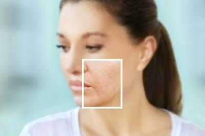 Woman with highlighted cheek showing fine lines and skin aging signs