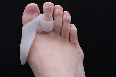 Bunion Prevention Tips: How To Avoid Bunion Development