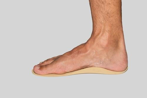 Flat-Feet-and-Custom-Orthoticsc