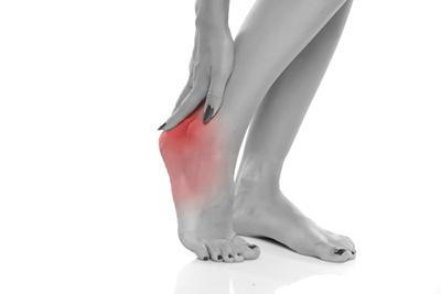 Lady-with-Plantar-Fasciitis