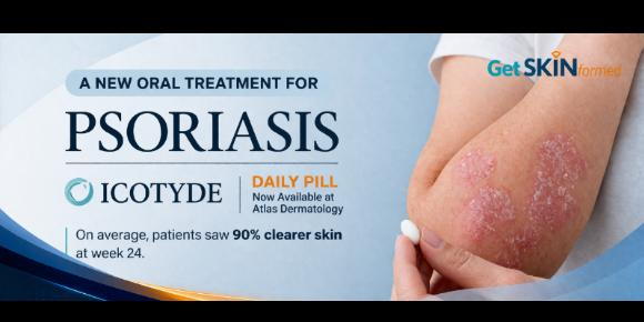 ICOTYDE for Psoriasis