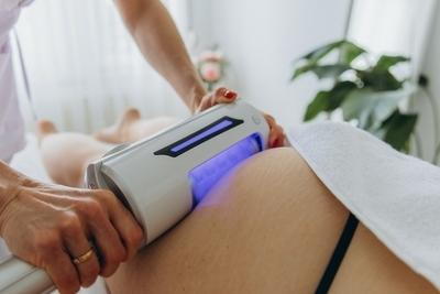 Illustration of Cellulite Treatment