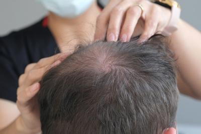 Skin-Doctor-Checking-Patient's-Hair-Loss