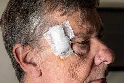 After MOHS Surgery Procedure