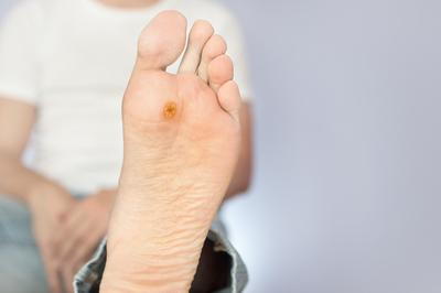 Person with foot ulcer