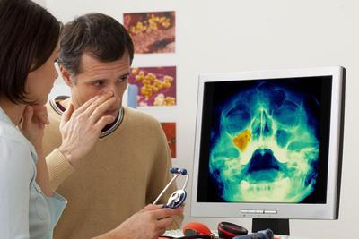 Doctor talking to a patient with sinus xray