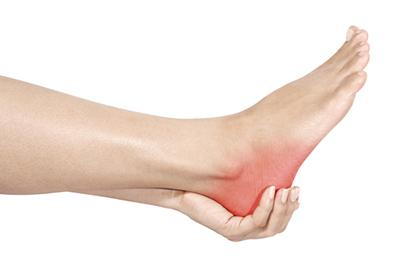 Plantar Fasciitis pain in red