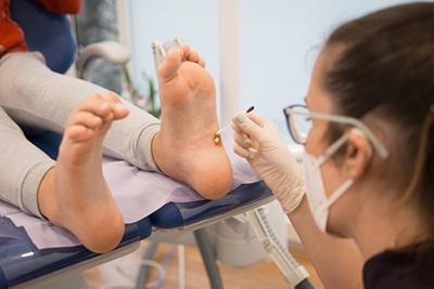 Podiatrist-Treating-Client's-Plantar-Warts