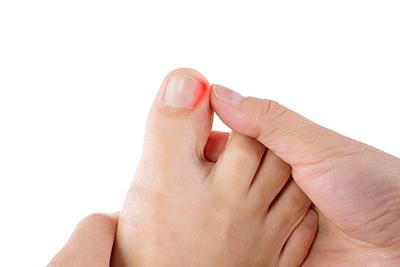 Are You Cutting Your Toenails the Right Way?: The Foot & Ankle