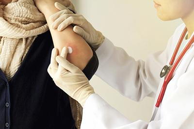 Dermatologist managing skin condition using topical medication