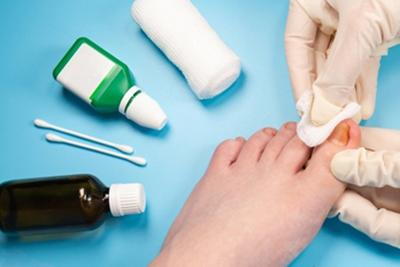 Illustration-of-removing-Ingrown-in-Patient-Foot