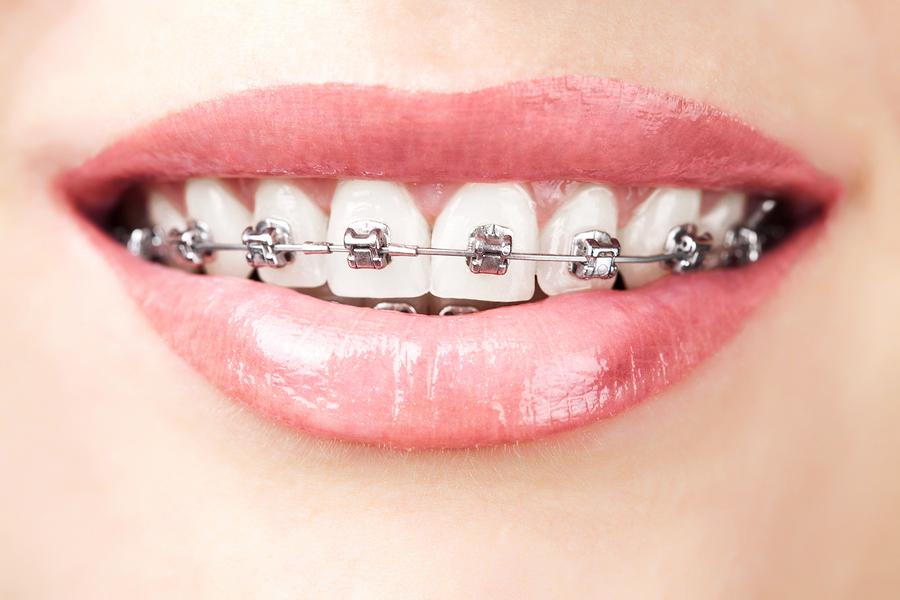 Orthodontic Web Design