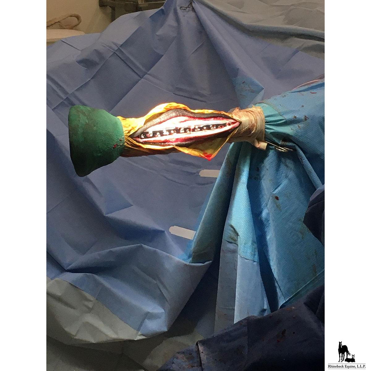 Fetlock Arthrodesis Surgery with Dr. Jim Nutt DACVS Fetlock Arthrodesis Surgery with Dr. Jim Nutt DACVS