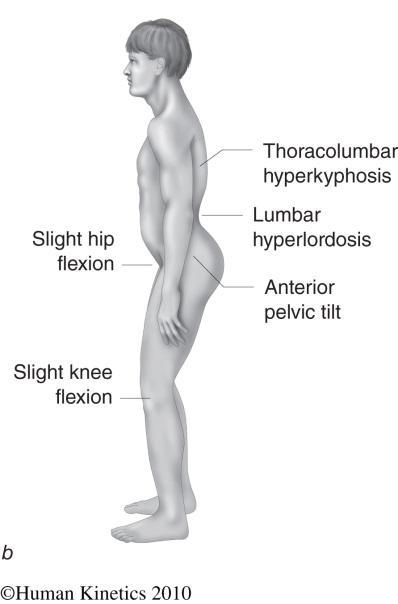 The Importance of Your Glutes