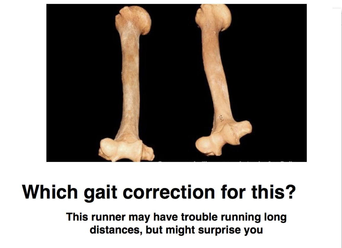 gait correction