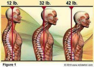 Poor posture linked to decreased lifespan.